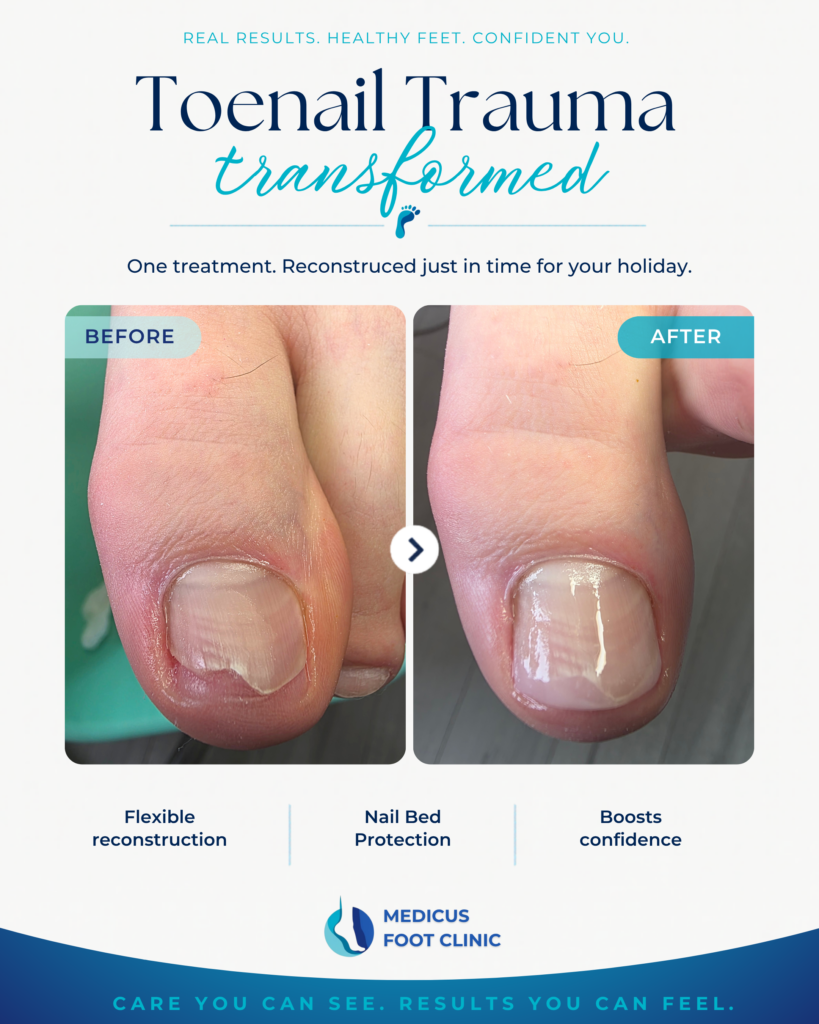 Toenail reconstruction