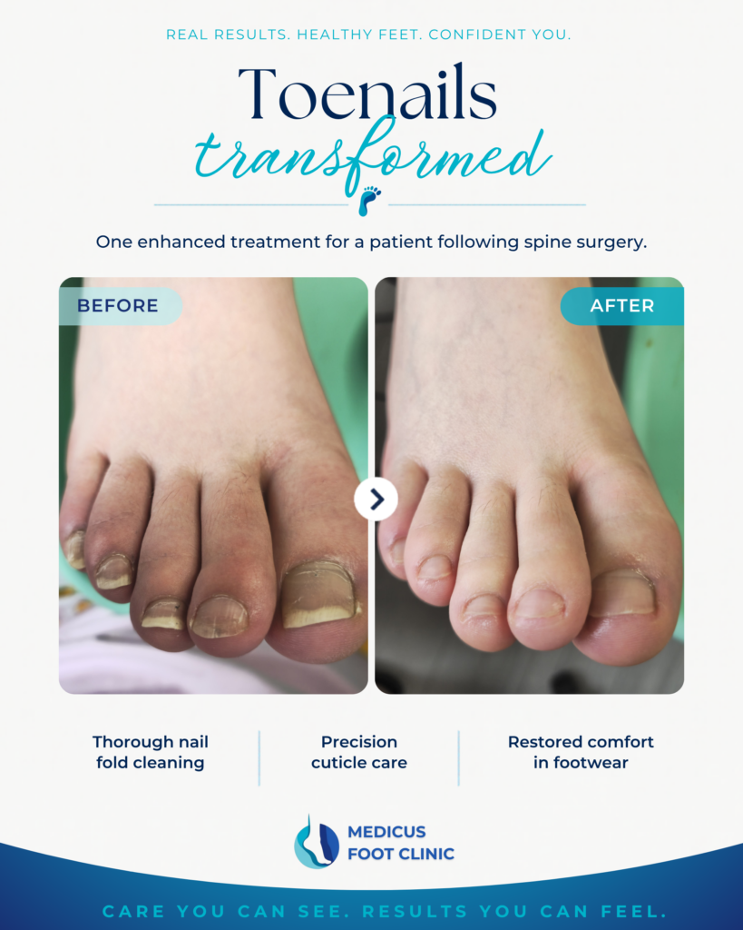 Toenails